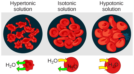 La partie gauche de cette illustration montre des globules rouges ratatinés baignés dans une solution hypertonique. La partie centrale montre des globules rouges sains baignés dans une solution isotonique, et la partie droite montre des globules rouges gonflés baignés dans une solution hypotonique.