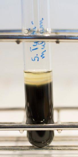 SIM test tube showing bacterial test results.