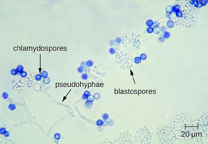 Microscope image of Candida albicans cells.