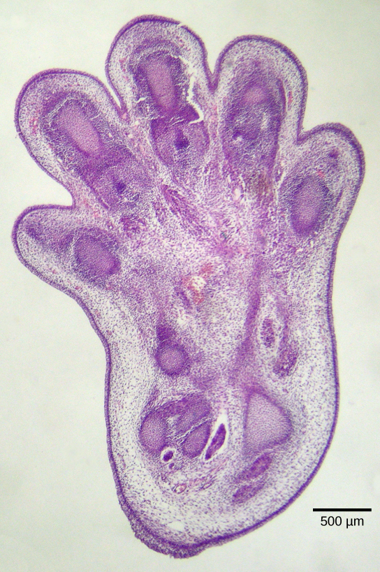 Esta foto mostra uma seção histológica de um pé de um embrião de camundongo de 15 dias de idade. O tecido conecta o espaço entre os dedos.