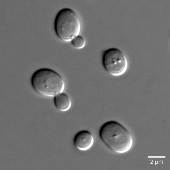 A foto mostra células de levedura, algumas das quais têm gemas saindo delas.