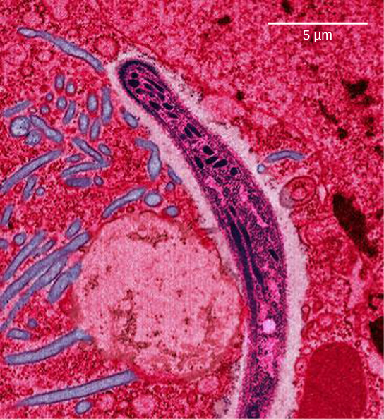 صورة تظهر بعوضة Anopheles gambiae التي تحمل الملاريا. تُظهر الصورة ب صورة مجهرية لطفيلي Plasmodium falciparum على شكل منجل، وهو الطفيل الذي يسبب الملاريا. يبلغ عرض البلازموديوم حوالي 0.75 ميكرون.