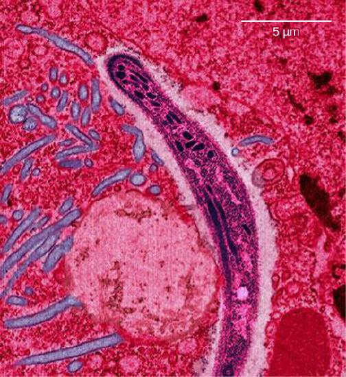 Photo a shows the Anopheles gambiae mosquito, which carries malaria. Photo b shows a micrograph of sickle-shaped Plasmodium falciparum, the parasite that causes malaria. The Plasmodium is about 0.75 microns across.