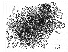 Electron Micrograph of Nucleoid DNA