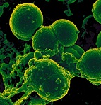 22: Prokaryotes - Bacteria and Archaea