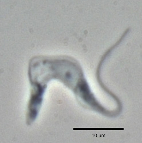 Micrograph inaonyesha T. brucei, ambayo ina mwili wa kiini wenye umbo la u na mkia mrefu.