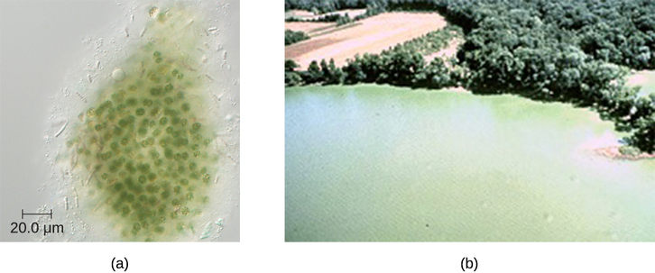 a) Una micrografía de células esféricas verdes. B) Una foto de un lago verde