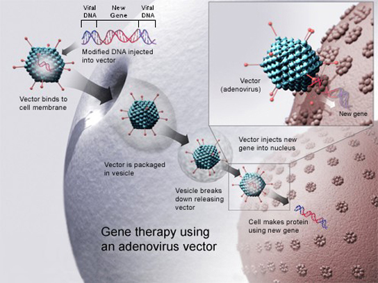 Pour guérir une maladie à l'aide d'un vecteur d'adénovirus, un nouveau gène destiné à remplacer un gène défectueux est encapsulé dans le génome de l'adénovirus. Les gènes qui rendent le virus pathogène sont supprimés. L'ADN modifié est placé à l'intérieur de la capside, ou enveloppe protéique du virus. La personne à guérir est infectée par le virus modifié. L'ADN viral entre dans le noyau, où le gène modifié peut remplacer le gène défectueux.