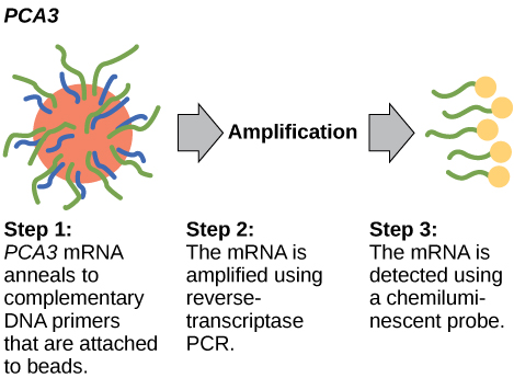 يحدث اختبار PCA3 في ثلاث خطوات. في الخطوة الأولى، يتم تلدين PCA3 mRNA إلى بادئات الحمض النووي التكميلية المرفقة بالخرز. في الخطوة الثانية، يتم تضخيم mRNA باستخدام PCR بالنسخ العكسي. في الخطوة الثالثة، يتم اكتشاف الحمض النووي الريبوزي باستخدام مسبار كيميائي مضيء.