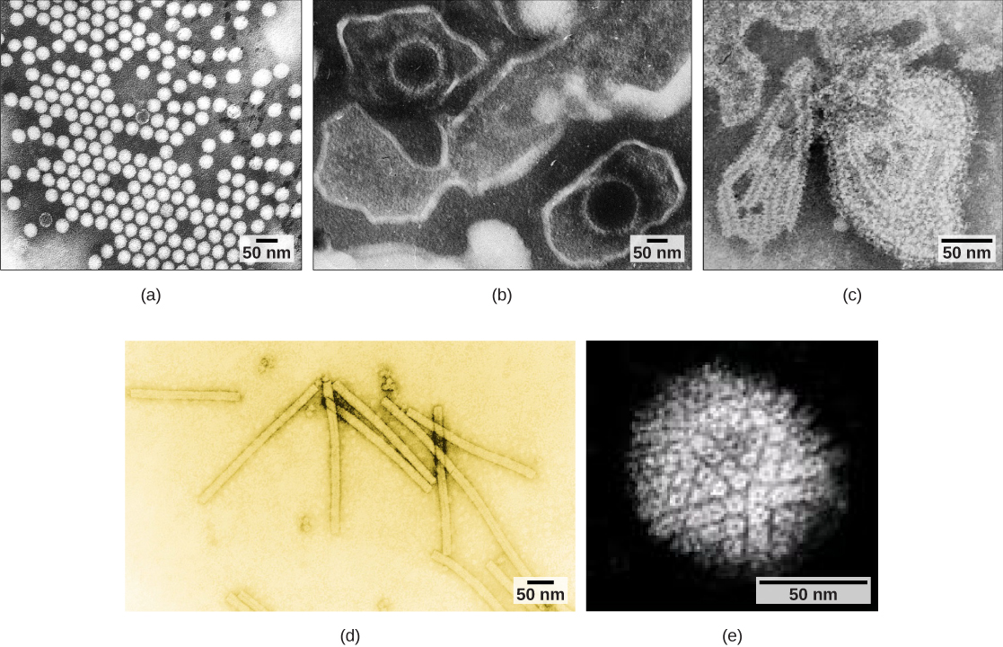 صورة مجهرية A تُظهر فيروسات شلل الأطفال ذات السحيح المُرتَّبة في شبكة؛ وتُظهر الصورة المجهرية (ب) فيروسين من نوع Epstein-Barr مزوَّدين بقبولات مُسطحة مُغطاة بغشاء بيضاوي؛ وتُظهر الصورة المجهرية (ج) قفازًا لفيروس النكاف مغلَّطًا بغشاء غير منتظم؛ وتُظهر صورة مجهرية (د) تبغ مستطيل الشكل؛ وفسيفساء (ج)؛ صورة مجهرية يُظهر غلافًا كرويًا من فيروس الهربس مرصعًا بالبروتينات السكرية.