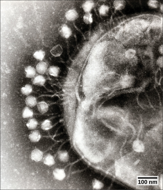 显微照片显示六角噬菌体衣壳由细长的茎附着在宿主细菌细胞上。