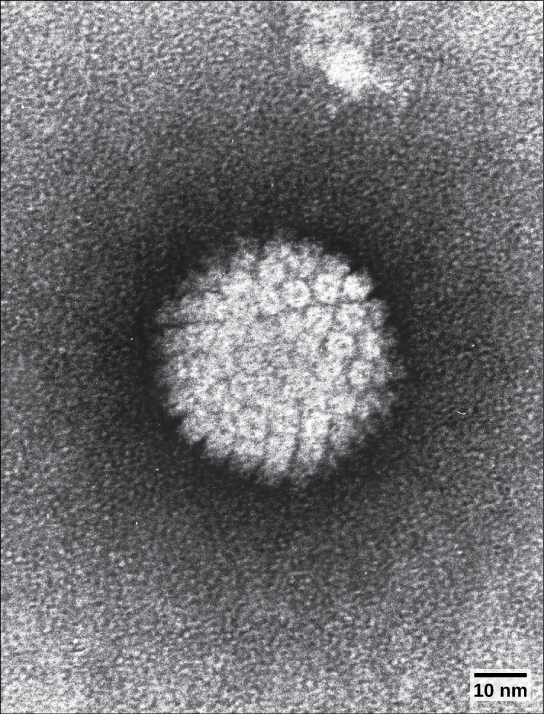 Micrograph inaonyesha virusi vya icosahedral na glycoproteins inayojitokeza kutoka capsid yake.