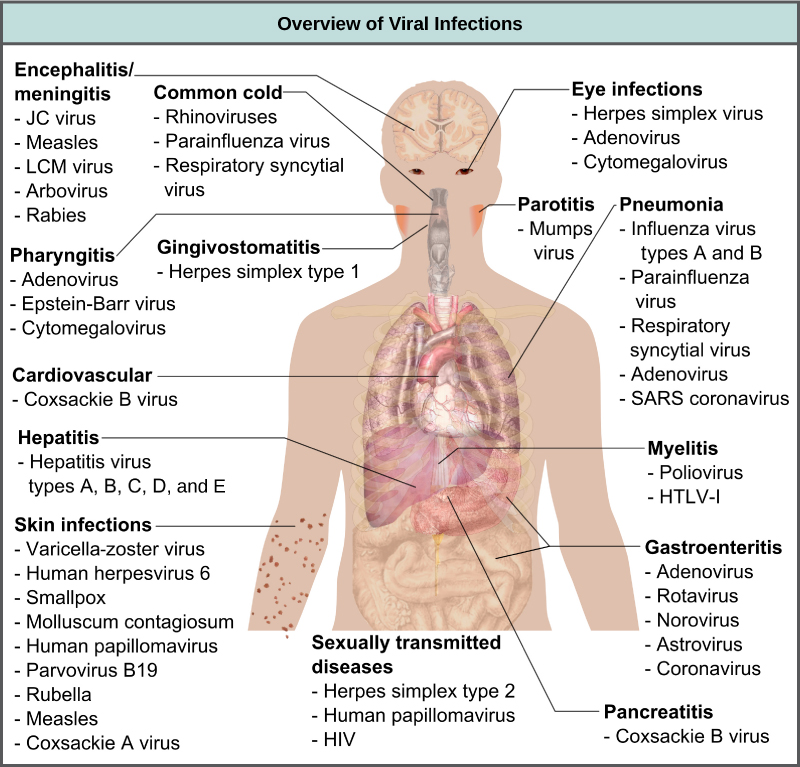 האיור מציג סקירה כללית של מחלות ויראליות אנושיות. וירוסים הגורמים לדלקת המוח או דלקת קרום המוח, או דלקת במוח וברקמות הסובבות, כוללים חצבת, ארבווירוס, כלבת, נגיף JC ונגיף LCM. הצטננות נגרמת על ידי נגיף רינו, נגיף parainfluenza ונגיף סינציאליאלי נשימתי. דלקות עיניים נגרמות על ידי הרפס ווירוס, אדנווירוס וציטומגלווירוס. דלקת הלוע, או דלקת של הלוע, נגרמת על ידי אדנווירוס, וירוס אפשטיין-בר, ו cytomegalovirus. Parotitis, או דלקת של בלוטות הפרוטיד, נגרמת על ידי וירוס חזרת. דלקת חניכיים, או דלקת ברירית הפה, נגרמת על ידי נגיף הרפס סימפלקס מסוג I. דלקת ריאות נגרמת על ידי נגיפי שפעת מסוג A ו- B, נגיף parainfluenza, נגיף סינסיטיאלי בדרכי הנשימה, אדנווירוס ונגיף SARS. בעיות לב וכלי דם נגרמות על ידי וירוס coxsackie B. הפטיטיס נגרמת על ידי נגיף הפטיטיס מסוג A, B, C, D ו- E. מיאליטיס נגרמת על ידי פוליו-וירוס ו- HLTV-1. דלקות עור נגרמות על ידי נגיף אבעבועות רוח, נגיף הרפס אנושי 6, אבעבועות שחורות, מולוסקום קונטגיאוסום, נגיף הפפילומה האנושי, פרבווירוס B19, אדמת, חצבת ונגיף קוקסאקי A. גסטרואנטריטיס, או מחלת עיכול, נגרמת על ידי אדנווירוס, נגיף רוטה, נורובירוס, אסטרווירוס וקורונה. מחלות המועברות במגע מיני נגרמות על ידי הרפס סימפלקס מסוג 2, וירוס הפפילומה האנושי ו- HIV. דלקת הלבלב B נגרמת על ידי נגיף קוקסאקי B.