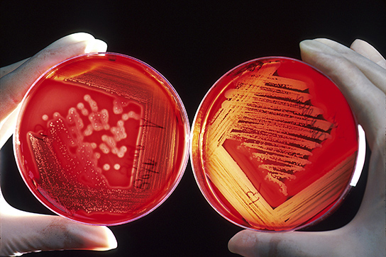 מוצגות שתי צלחות חיידקיות עם אגר אדום. שתי הצלחות מכוסות במושבות חיידקים. בצלחת הימנית, המכילה חיידקים המוליטיים, האגר האדום התבהר היכן גדלים חיידקים. בצלחת השמאלית, המכילה חיידקים שאינם המוליטיים, האגר אינו ברור.
