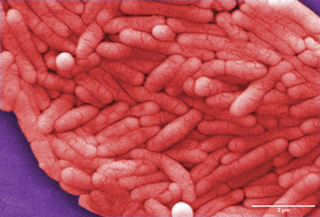 La micrographie montre une bactérie rose en forme de bâtonnet.