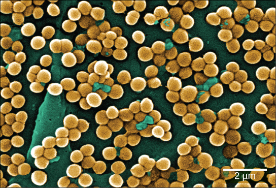 המיקרוגרף מראה אשכולות של חיידקים עגולים הנצמדים למשטח. רוחב כל חיידק הוא כ -0.4 מיקרון.