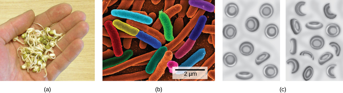 تُظهر الصورة A بذور خضراء مستديرة مع سيقان تنبت منها. يُظهر الرسم B خلايا الدم الحمراء الطبيعية على شكل قرص على اليسار. على اليمين، تبدو العديد من خلايا الدم الحمراء على شكل منجل.