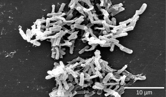 Micrograph inaonyesha makundi madogo ya bakteria nyeupe-umbo fimbo dhidi ya background giza.
