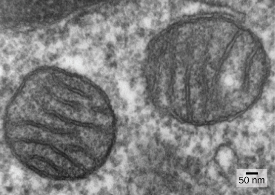 这张显微照片显示了细胞内两个圆形的膜结合细胞器。 细胞器的宽度约为400微米，中间有薄膜。