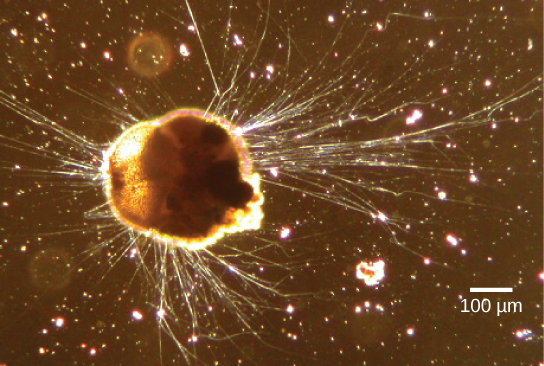 显微照片显示了一个半圆形的细胞，从中延伸出长而像头发一样的突起。