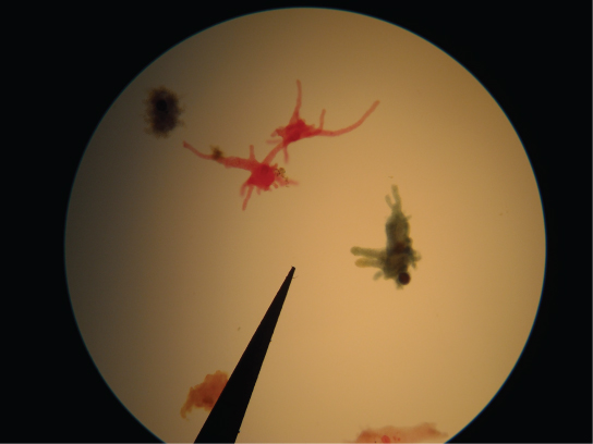 Micrograph inaonyesha amoebas na pseudopodia kama lobe-kama.