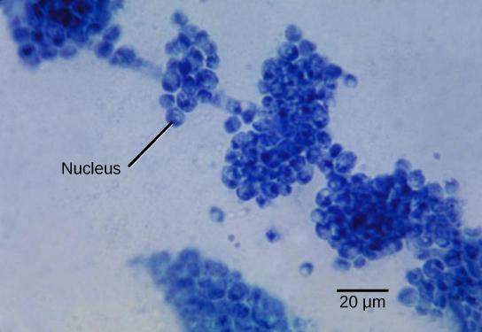 La micrographie montre des amas de petites sphères bleues. Chaque sphère mesure environ 5 microns de diamètre.