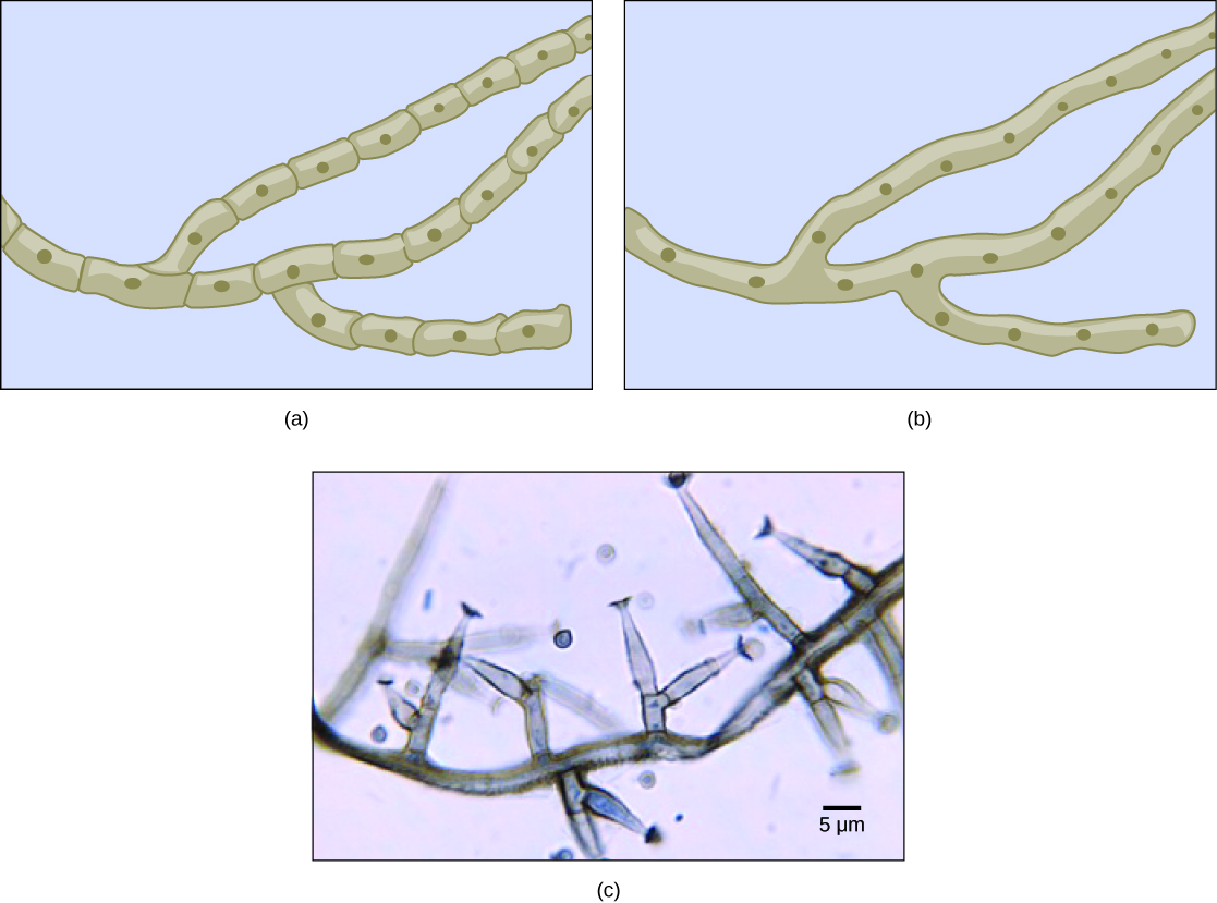 La partie A est une illustration d'hyphes cloisonnés. Les cellules situées à l'intérieur des hyphes cloisonnés sont rectangulaires. Chaque cellule possède son propre noyau et se connecte aux autres cellules bout à bout en formant un long brin. Deux branches apparaissent dans les hyphes. La partie B est une illustration des hyphes coenocytaires. Comme les hyphes cloisonnés, les hyphes coenocytaires sont constitués de longues fibres ramifiées. Cependant, dans les hyphes coenocytaires, il n'y a pas de séparation entre les cellules ou les noyaux. La partie C est une micrographie optique d'hyphes septés chez Phialophora richardsiae. Les hyphes sont constitués d'une longue chaîne de cellules à plusieurs branches. Chaque branche mesure environ 3 µm de large et varie de 3 à 20 µm de longueur.