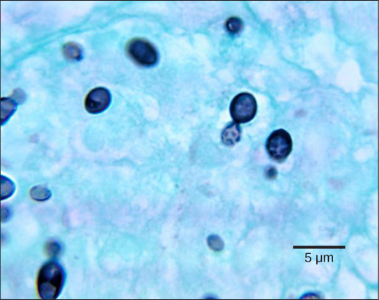 La micrographie montre des cellules de levure bourgeonnantes. Les cellules mères sont colorées en bleu foncé et rondes, et des cellules plus petites en forme de larme jaillissent à partir d'elles. Les cellules mesurent environ 2 microns de diamètre et 3 microns de long.