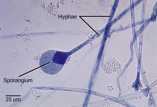 Micrograph shows several long, thread-like hyphae stained blue. 