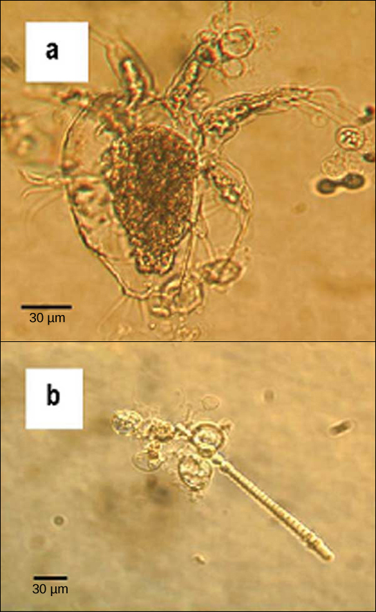 La micrografía A muestra un artrópodo, que es un organismo transparente en forma de gota de aproximadamente 90 micras de diámetro y 120 micras de largo. Apéndices similares a tentáculos sobresalen del frente, extremo ancho del organismo y racimos de apéndices similares a cilias justo fuera de ambos lados y de la parte posterior. Organismos ovales transparentes de aproximadamente 20 micras de ancho se adhieren al artrópodo. La micrografía B muestra organismos transparentes ovalados similares que se aferran a algas en forma de varilla de aproximadamente 5 micras de ancho y 200 micras de largo.