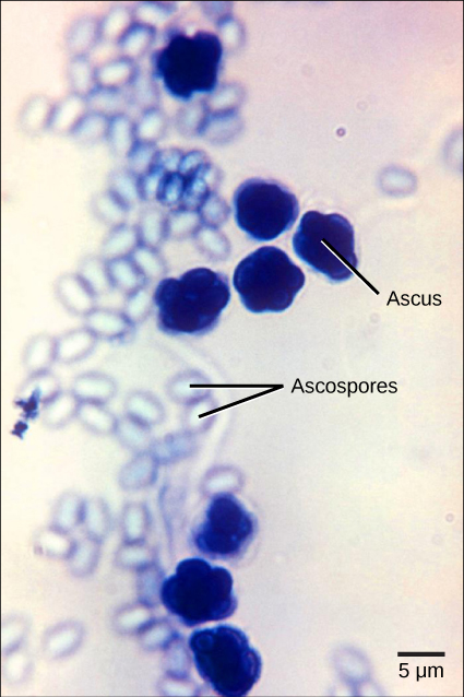 La micrografía muestra asci, que aparecen como múltiples formas esféricas fusionadas en una estructura de aproximadamente 7 micras de ancho, y ascosporas, que son pequeños óvalos de color azul claro de aproximadamente dos micras de ancho por tres micras de largo liberadas del asci.