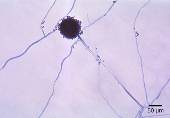 La micrographie montre le mycélium d'Aspergillus, qui ressemble à de longs fils, et un conidiophore sphérique d'environ 40 microns de diamètre.