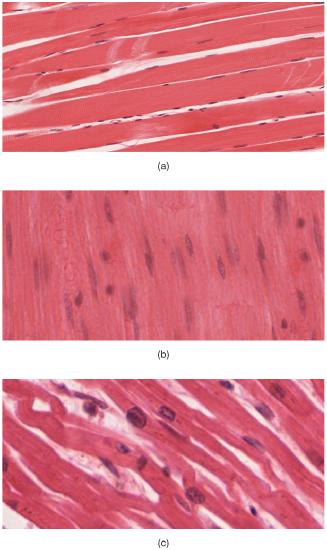 Skeletal, Smooth, and Cardiac muscle tissue micrographs
