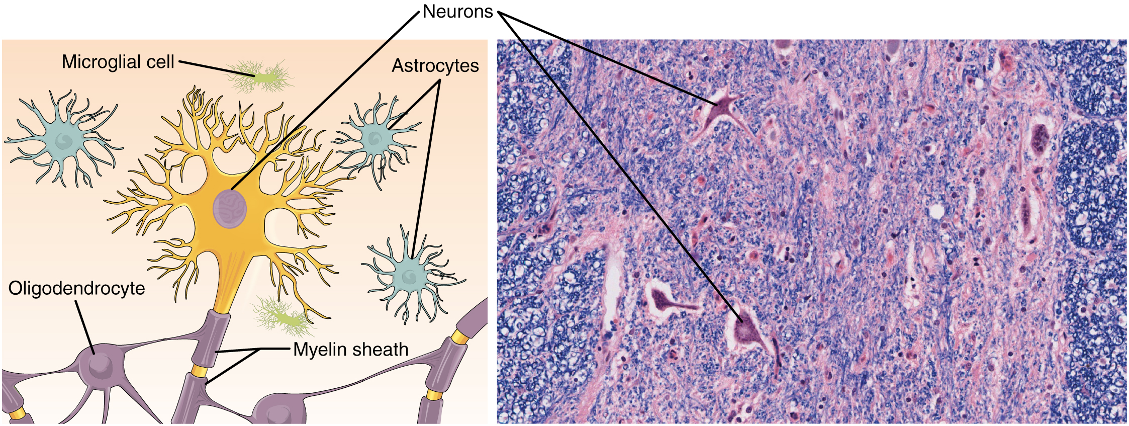  Nervous Tissue drawing with neurons and corresponding micrograph