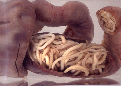 Piece of intestine, blocked by worms