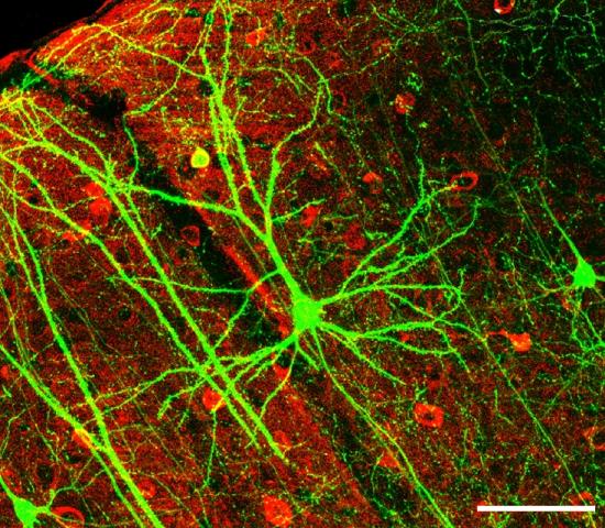 Neuron fluorescently stained