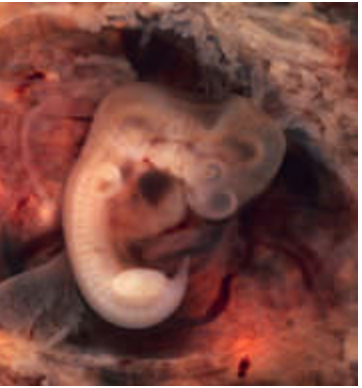 5 week old embryo