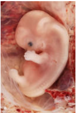 fetus 9 weeks old