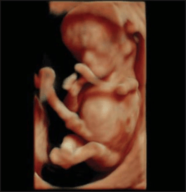 11 week old fetus
