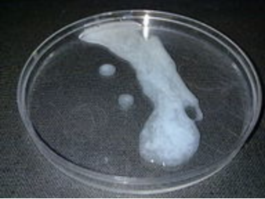 Human semen in a petri dish