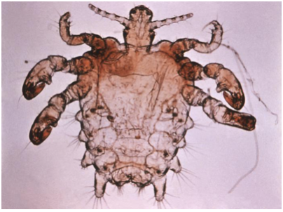 Pthirus pubis - crab louse