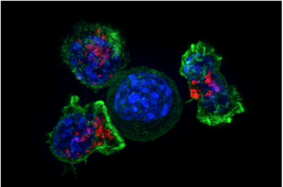 Killer T cells surround a cancer cell