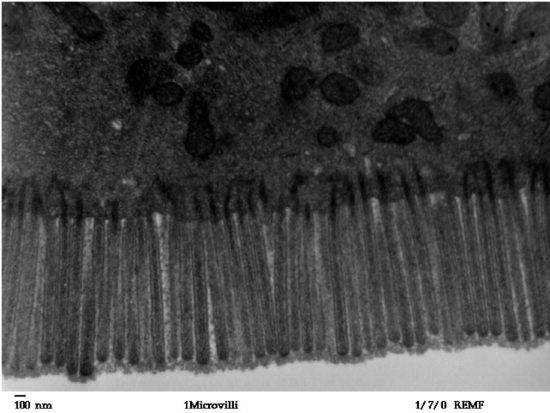 Human jejunum microvilli 