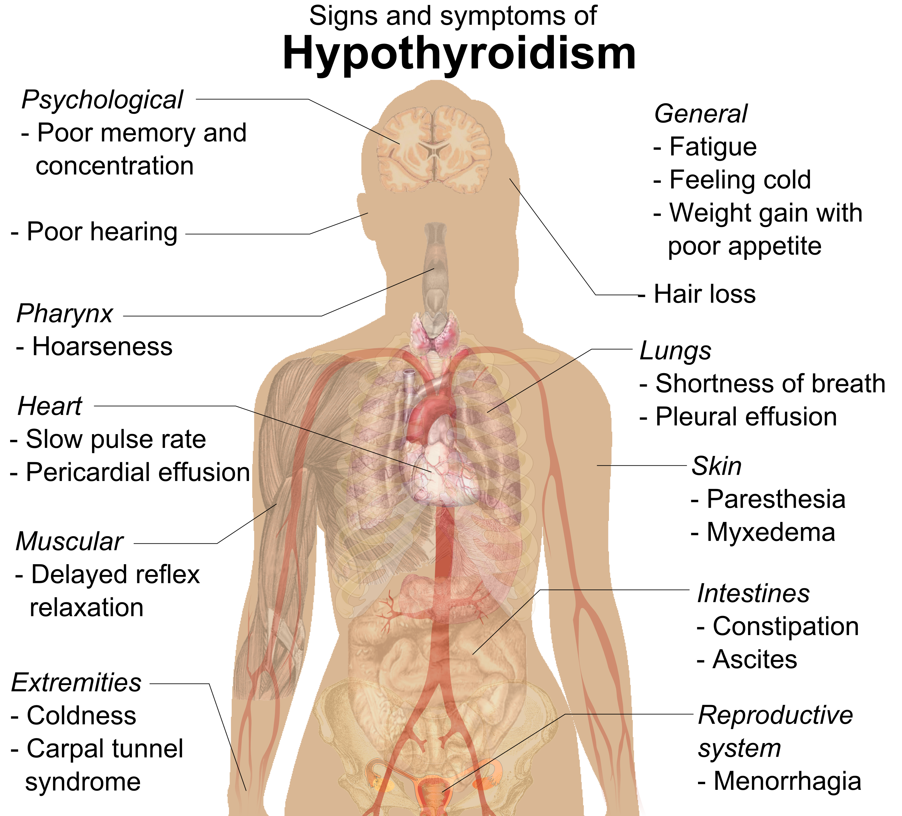 Signs and symptoms of hypothyroidism