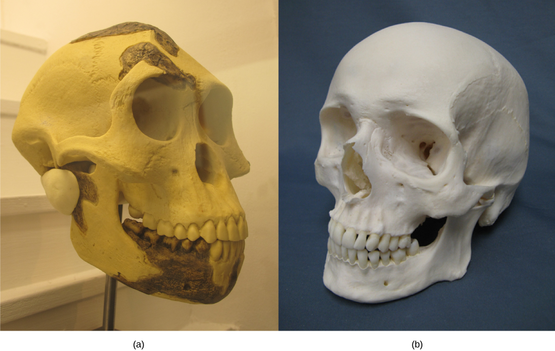 照片 A 显示了一个 A. afarensis 头骨，其形状相似，但额头向后倾斜，下巴伸出。 照片 A 显示的是人类头骨。