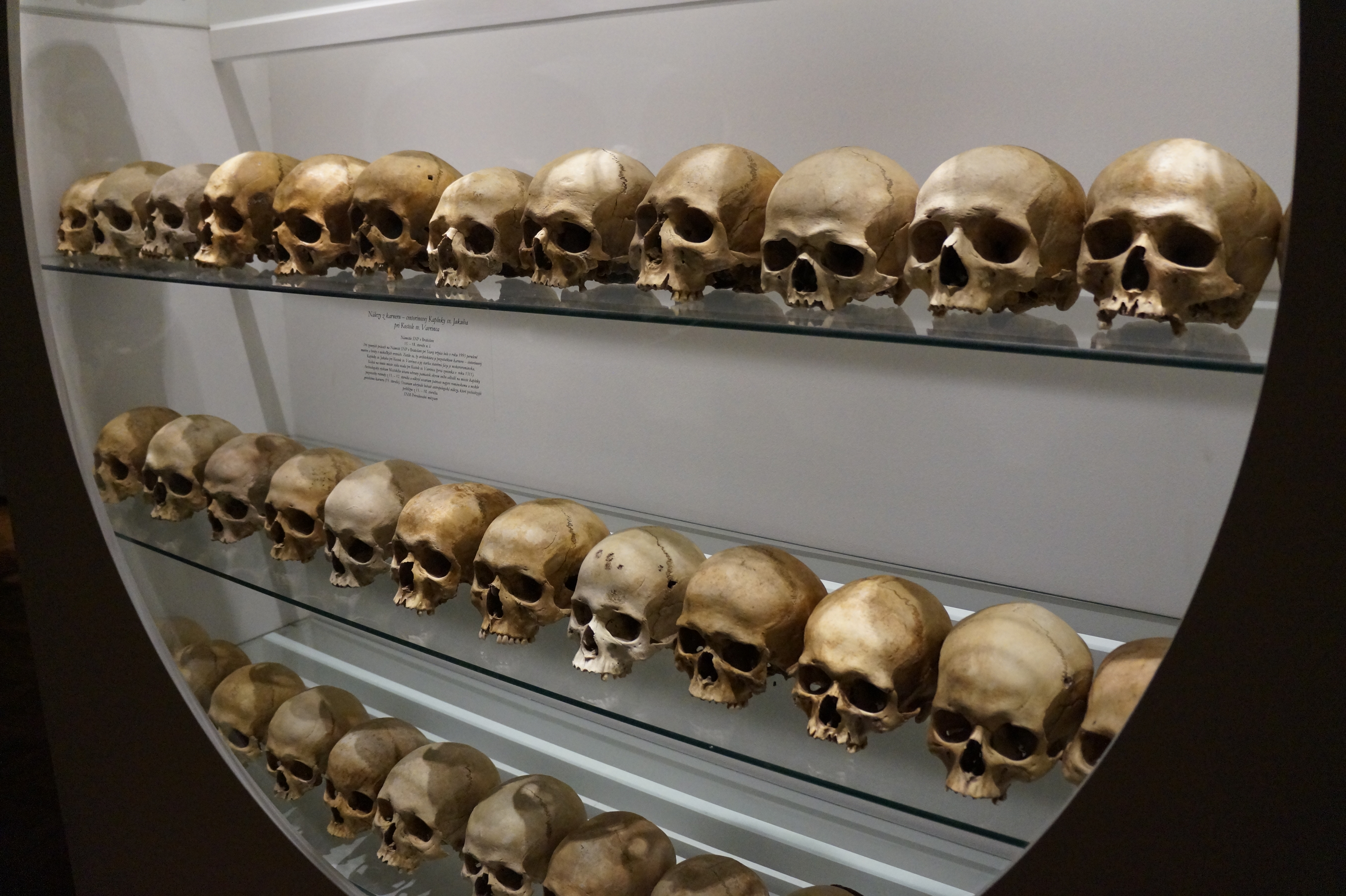 Human skulls on display