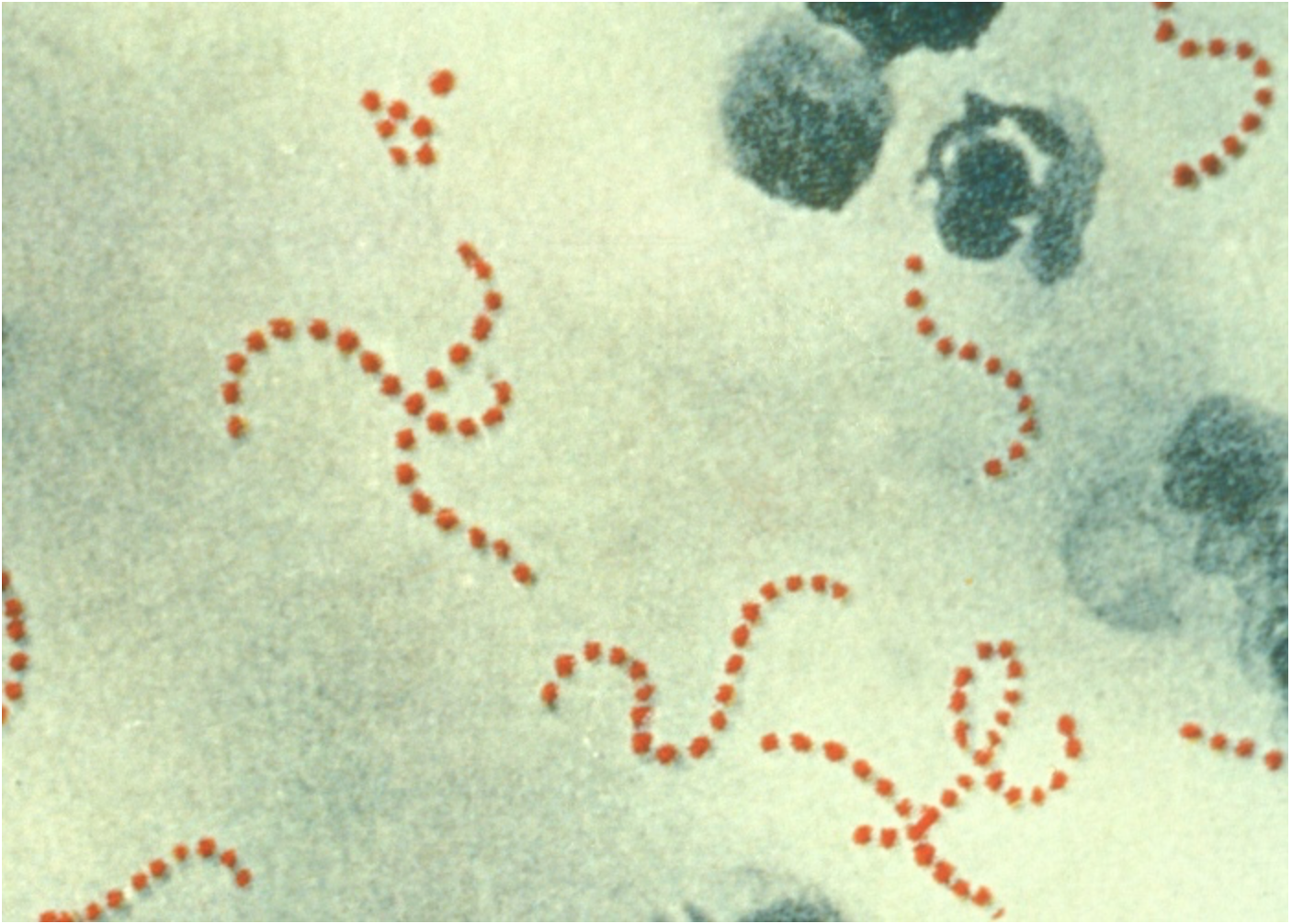 Streptococcus pyogenes drawing