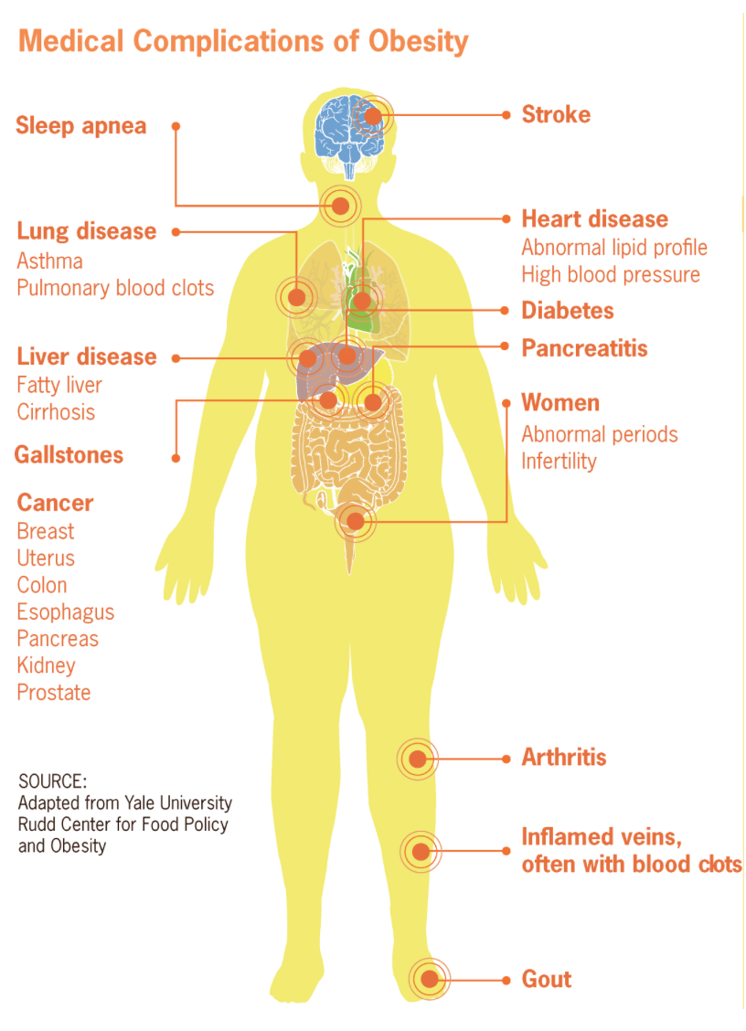 Chart of medical complications of obesity