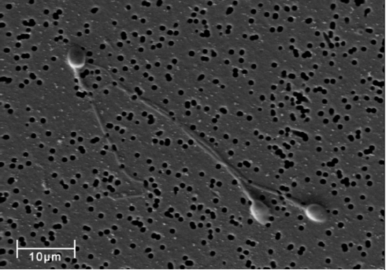 human Spermatozoa micrograph
