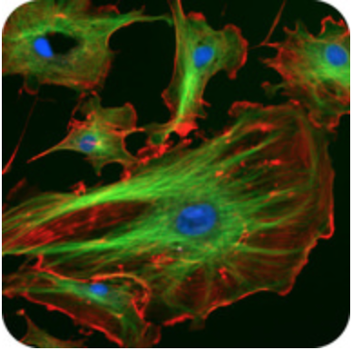 Fluorescent actin and microtubules 